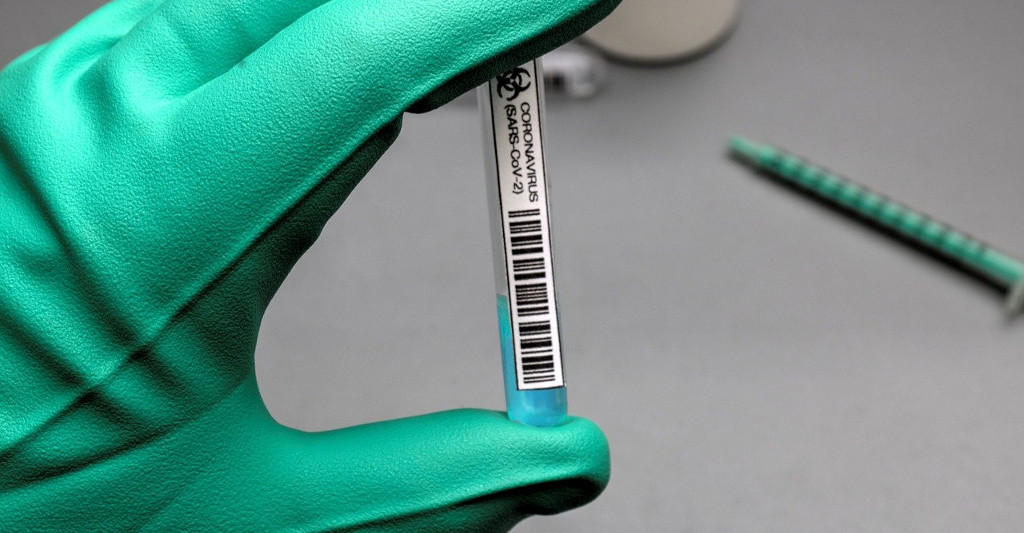 La Unión Europea aprueba exenciones de IVA a vacunas y tests covid